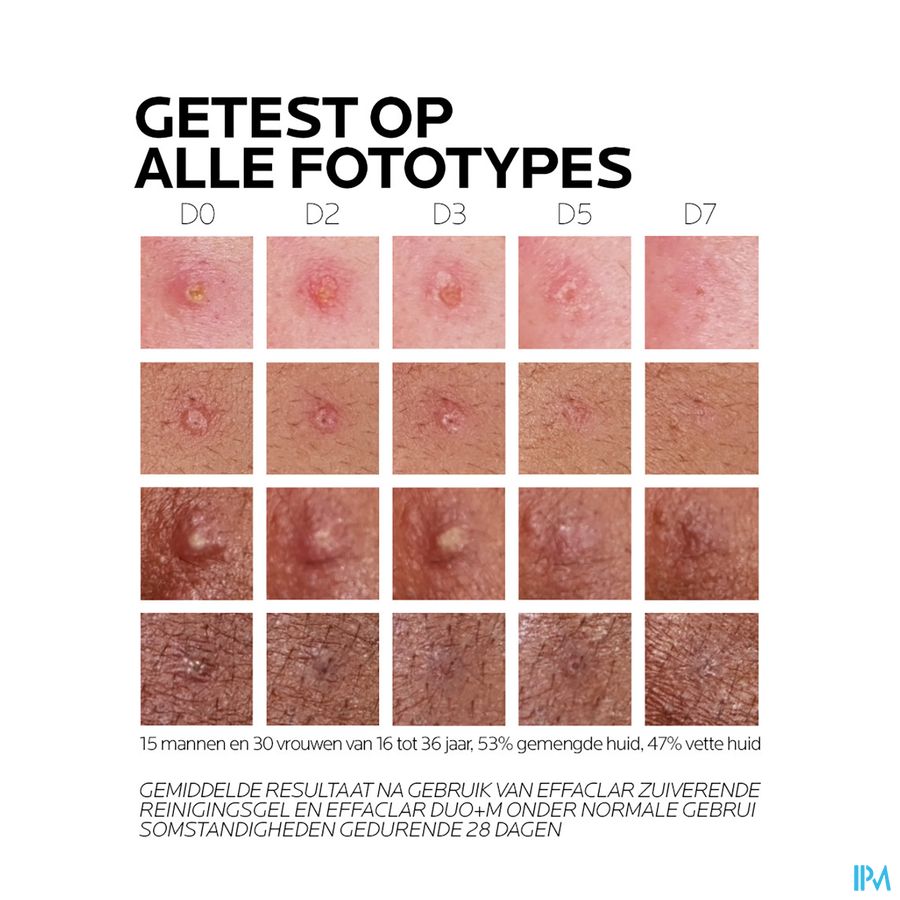 Lrp Effaclar Duo + M Creme 40ml 10