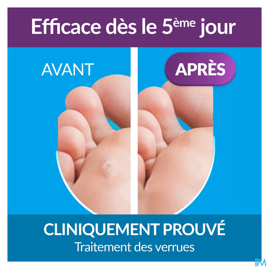 Excilor Wrattenbehandeling Duo Power 10ml+1,5g 5