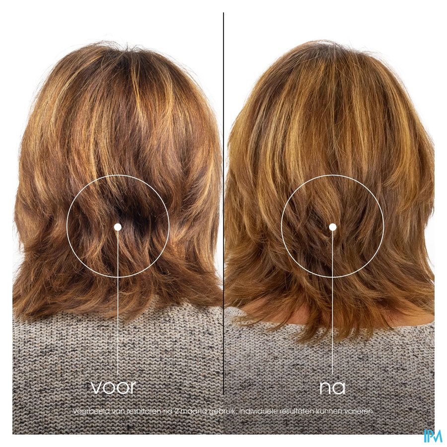 Klorane Capil. Sh Granaatappel 400ml 6