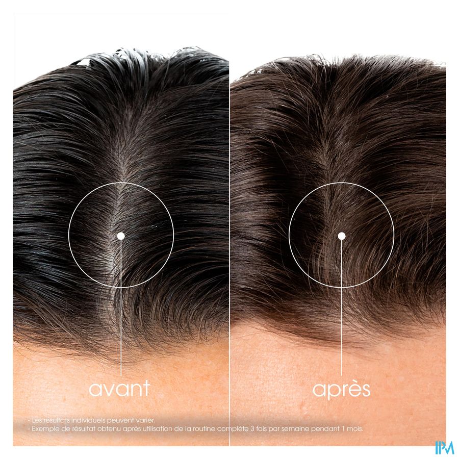 Klorane Capil. Sh Quinine & Edelweiss 400ml Nf 5