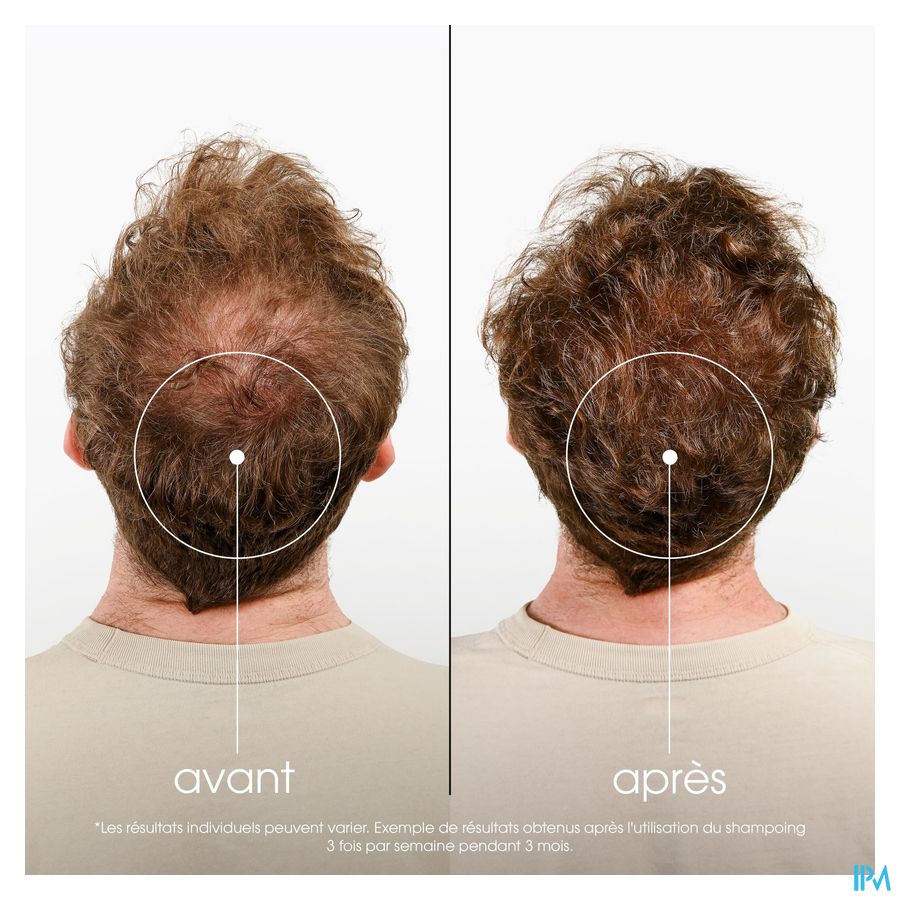 Klorane Capil. Sh Quinine & Edelweiss 400ml Nf 15