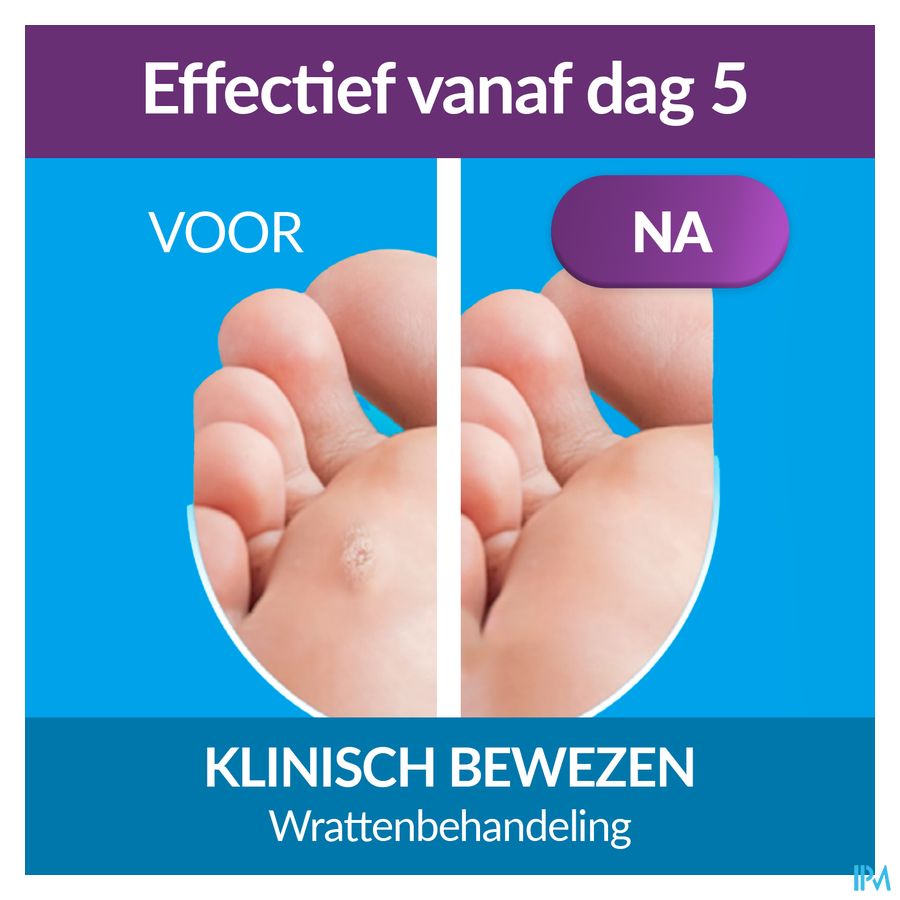 Excilor Wrattenbehandeling Duo Power 10ml+1,5g 9