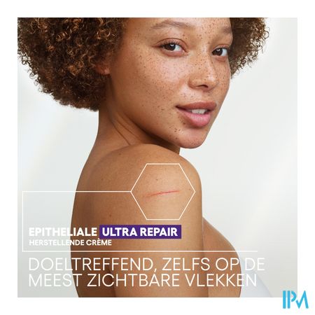 Aderma Epitheliale Creme A/vlekken 100ml 3