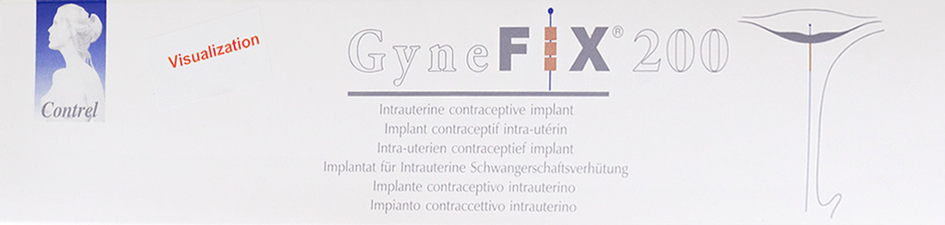 Gynefix 200 Iud 3