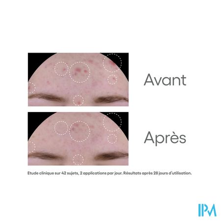 Aderma Biology Ac Global Soin A/imperfections 40ml 5