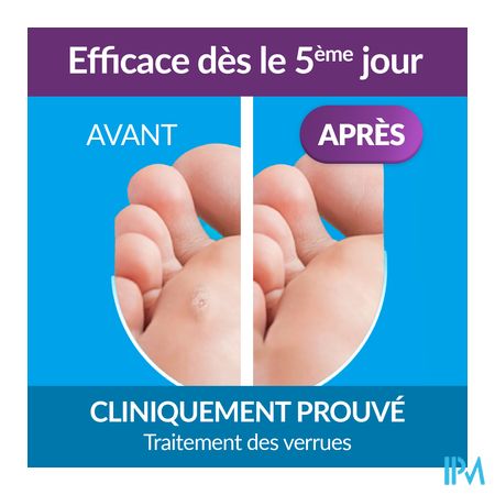 Excilor Traitement Verrues Duo Power 10ml+1,5g 3