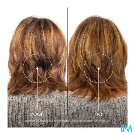 Klorane Capil. Balsem Grenaatappel 200ml