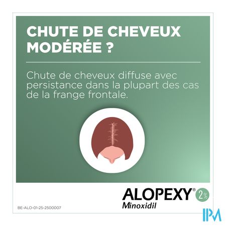 Alopexy 2 % Liquid Fl Pipet/spray 3x60ml 8