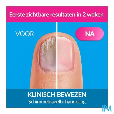 Excilor Liquid 3,3ml