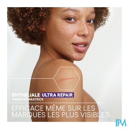 Aderma Epitheliale Creme A/vlekken 100ml 11