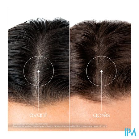 Klorane Capil. Sh Quinine & Edelweiss 400ml Nf 5