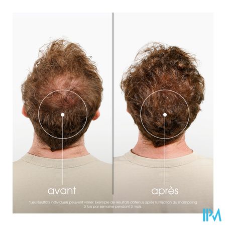 Klorane Capil. Sh Quinine & Edelweiss 200ml Nf 4