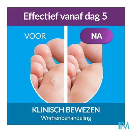 Excilor Wrattenbehandeling Duo Power 10ml+1,5g 8
