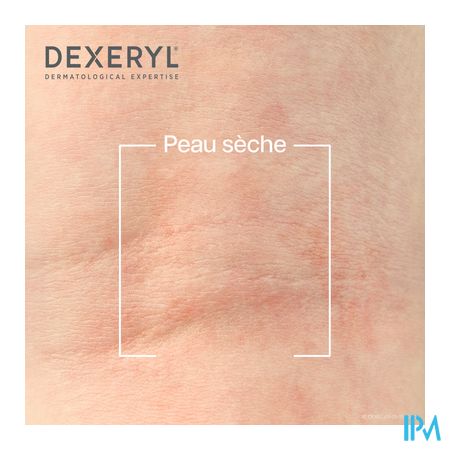 Dexeryl Creme Tube 250g 35